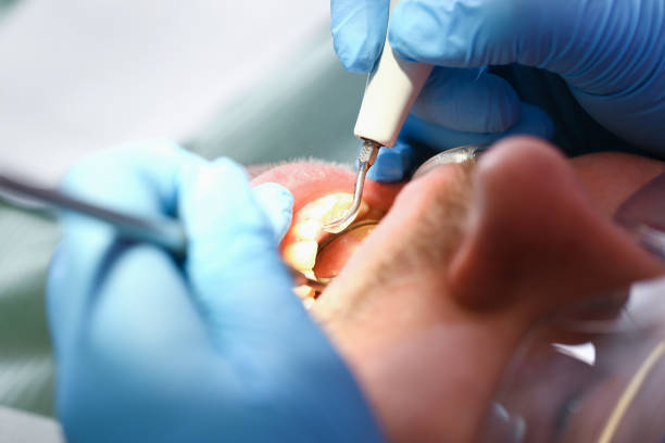 Best After-Hours Dental Trauma Care in Merrill, IA